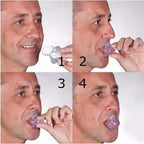 Tongue Stabiliser – anti-snoring mouthpiece, medical silicone